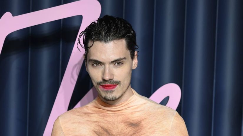 Mysli to vazne Influencer s odhalenym rozkrokom sokoval na cervenom koberci Rita Ora a Sharon Stone sa mohli aj roztrhat