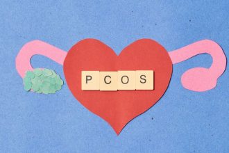 Vedci priznal obrovsky omyl Chorobu milionov zien cele desatrocia zle pomenovali Preco ma byvaly syndrom PCOS nove meno