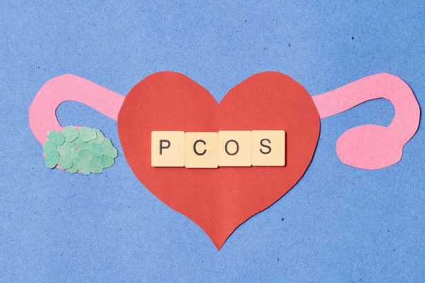 Vedci priznal obrovsky omyl Chorobu milionov zien cele desatrocia zle pomenovali Preco ma byvaly syndrom PCOS nove meno