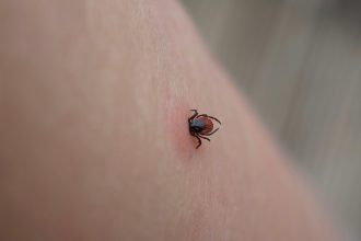 Nebezpecny moze byt aj bezny obed Uhryznutie kliestom moze vyvolat smrtelnu alergiu na maso