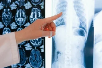 Srdce sa môže meniť bez príznakov. Vedci odhalili skryté riziko, ktoré mnohí podceňujú